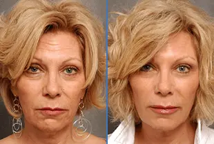 eternelle opinioni 3