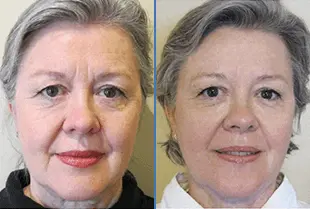 eternelle opinioni 4