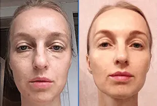 eternelle opinioni 5